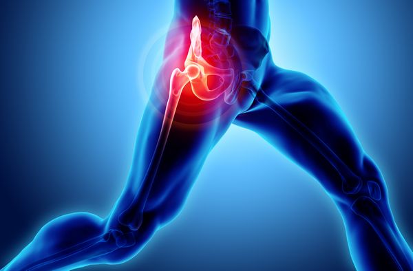 Bellevue Hip Pain Vibrant Health provides top performing hip pain therapies near 98004.