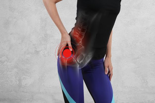 Bellevue Trochanteric Bursitis Bellevue Trochanteric Bursitis treatment will get you back to feeling great quickly!